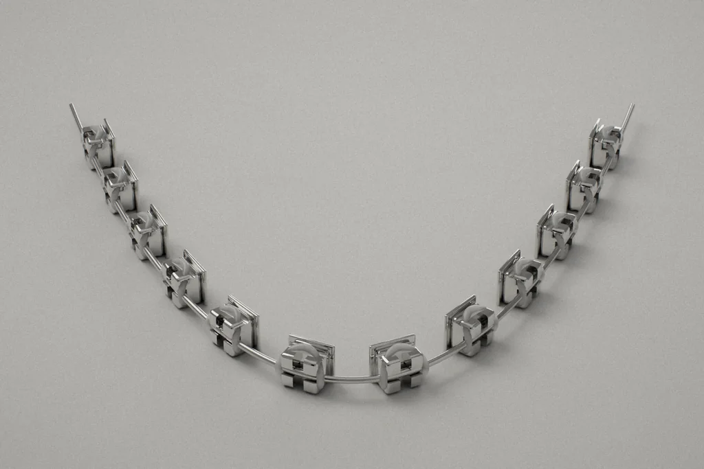 Arco de ortodoncia con brackets metálicos